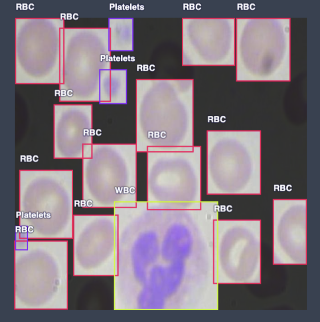 picture predicting white/red bloodcells and platelets